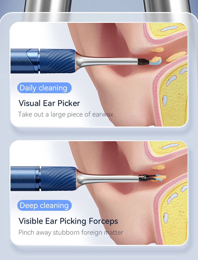 Premium 3-in-1 Wi-Fi Visual Ear Cleaning Tool – Camera Ear Pick with Tweezers, 12MP HD Imaging, Rechargeable Battery, Silicone Accessories