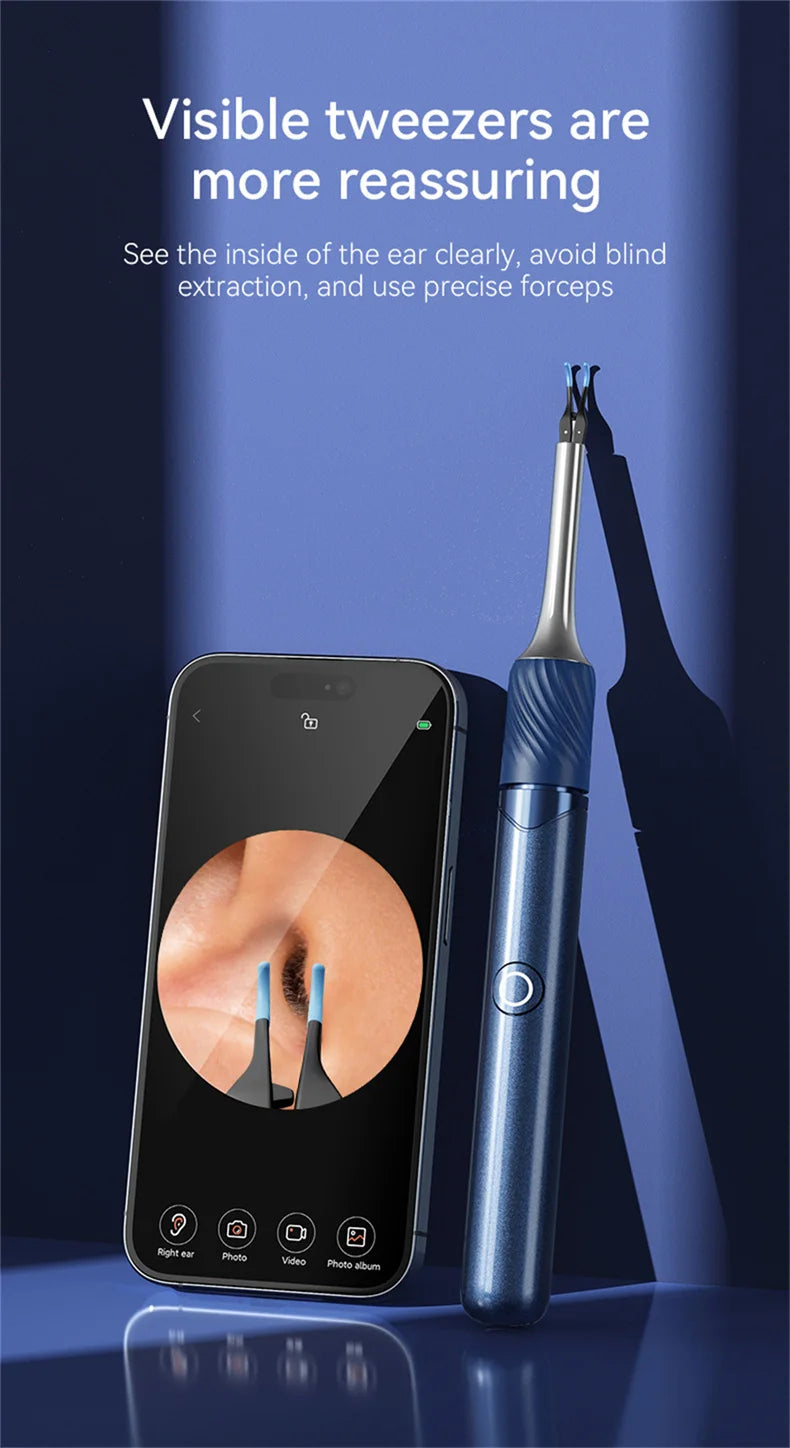 Premium 3-in-1 Wi-Fi Visual Ear Cleaning Tool – Camera Ear Pick with Tweezers, 12MP HD Imaging, Rechargeable Battery, Silicone Accessories