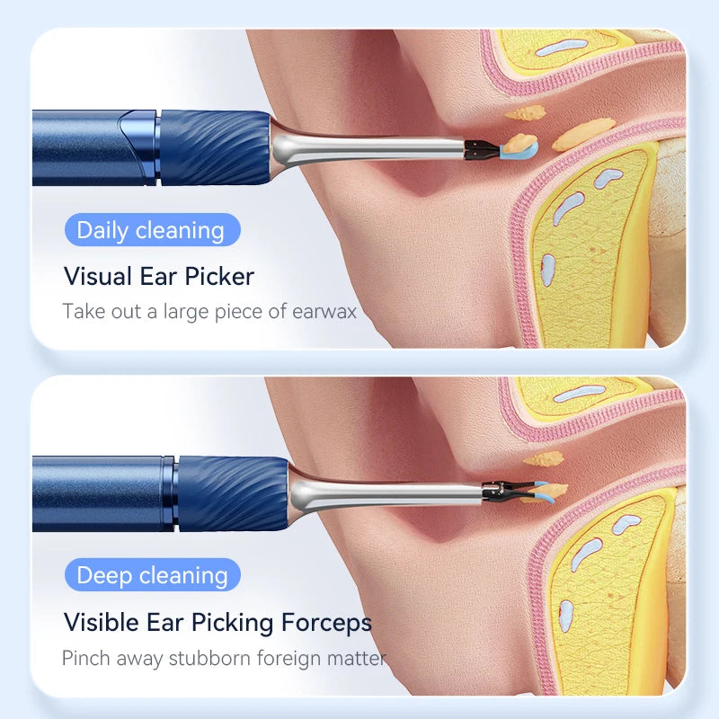Premium 3-in-1 Wi-Fi Visual Ear Cleaning Tool – Camera Ear Pick with Tweezers, 12MP HD Imaging, Rechargeable Battery, Silicone Accessories