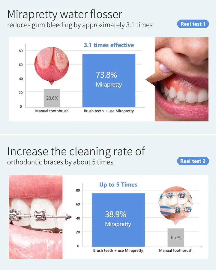 Premium 600ML Oral Irrigator – Multifunction Electric Water Flosser with 10 Modes and IPX7 Waterproof Design
