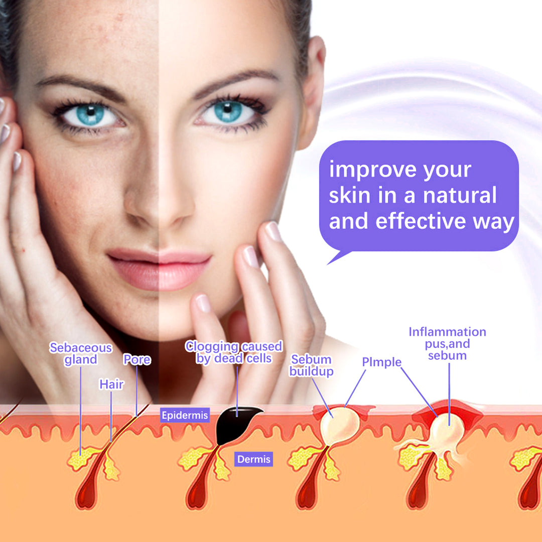 Premium High Frequency Facial Machine, Screen Display Electro Therapy Wand with Glass Tube, Anti-Acne & Wrinkle Removal, Skin Tightening & Spot Treatment Device, Ozone Sterilization, Improves Blood Circulation, Safe & Portable