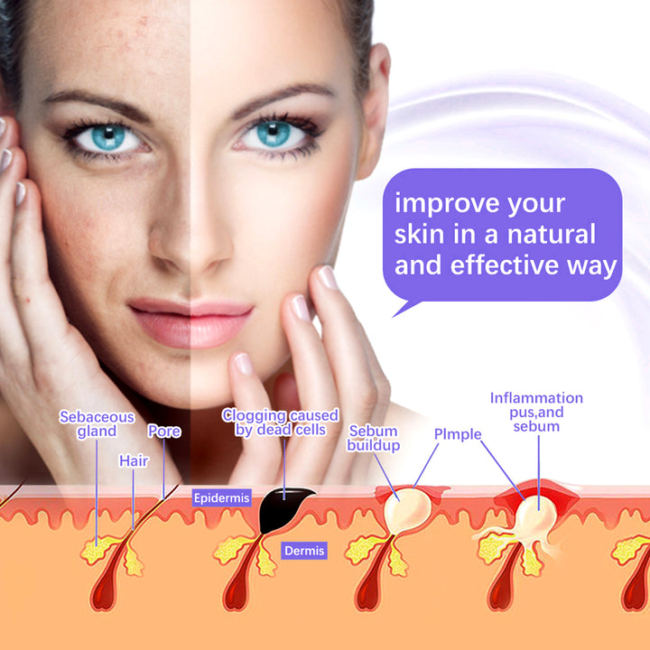 Premium High Frequency Facial Machine, Screen Display Electro Therapy Wand with Glass Tube, Anti-Acne & Wrinkle Removal, Skin Tightening & Spot Treatment Device, Ozone Sterilization, Improves Blood Circulation, Safe & Portable