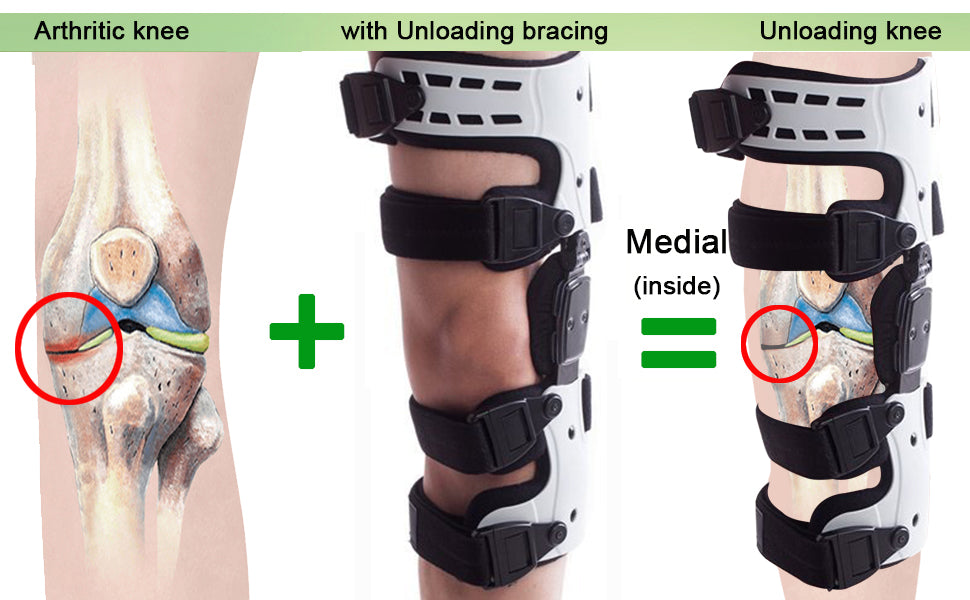 Premium OA Unloader Knee Brace – Adjustable Hinged Support with Medial Offloading and Range of Motion Control