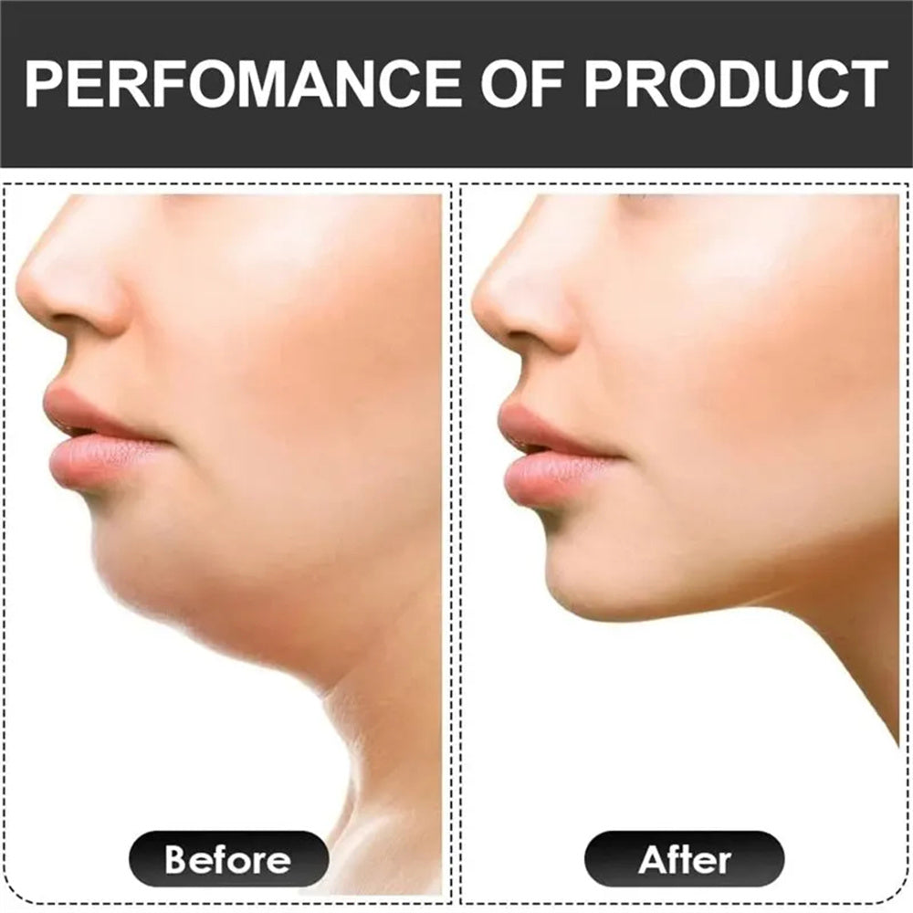 Premium U-Shape Jaw Exerciser – Facial Fitness & Jawline Training Equipment – Muscle Chew Ball for Mouth & Face, Double Chin Reducer, Jaw Strengthening & Chew Bite Breaker