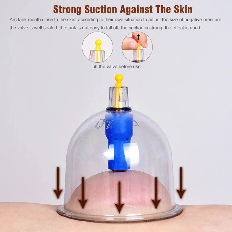 Premium Cupping Therapy Set – Professional Vacuum Suction Cups for Chinese Medicine Physiotherapy, Massage, and Muscle Relaxation, Durable Plastic Jars for Home and Professional Use - StrengthXPhysiotherapy
