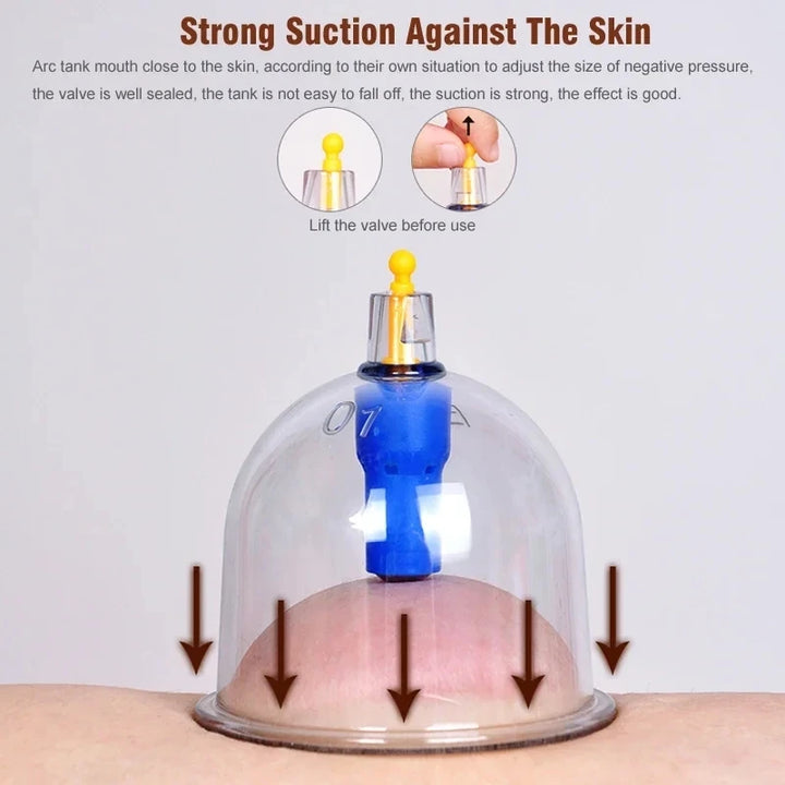 Premium Cupping Therapy Set – Professional Vacuum Suction Cups for Chinese Medicine Physiotherapy, Massage, and Muscle Relaxation, Durable Plastic Jars for Home and Professional Use - StrengthXPhysiotherapy